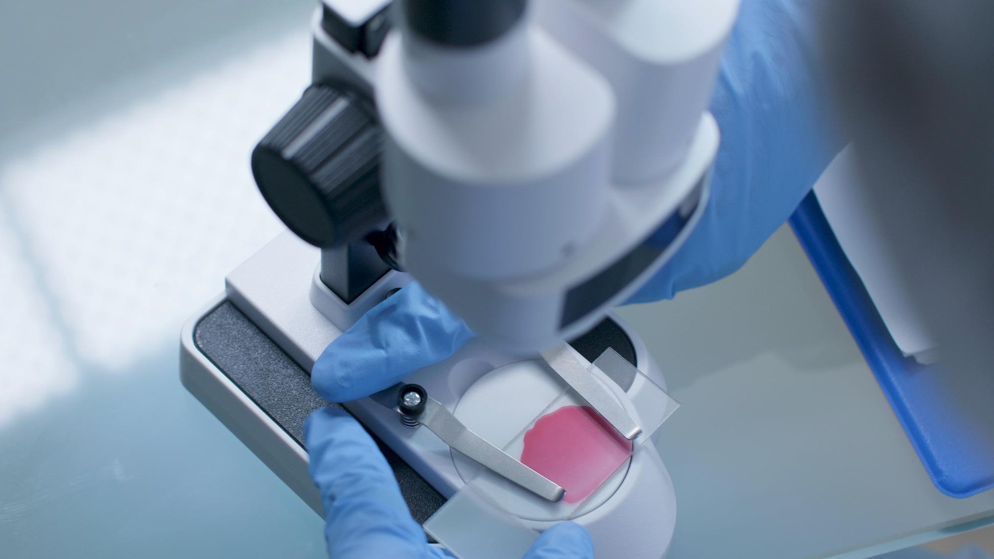 Biopsja aspiracyjna - badanie mikroskopem